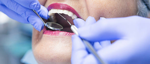 Best Emergency Tooth Extraction in Dunlap, TN